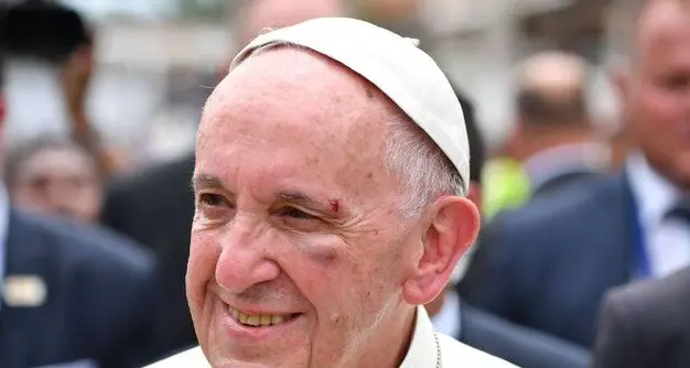 Paura per Papa Francesco: si sporge dalla papamobile per benedire la folla e urta contro il montante dell'auto