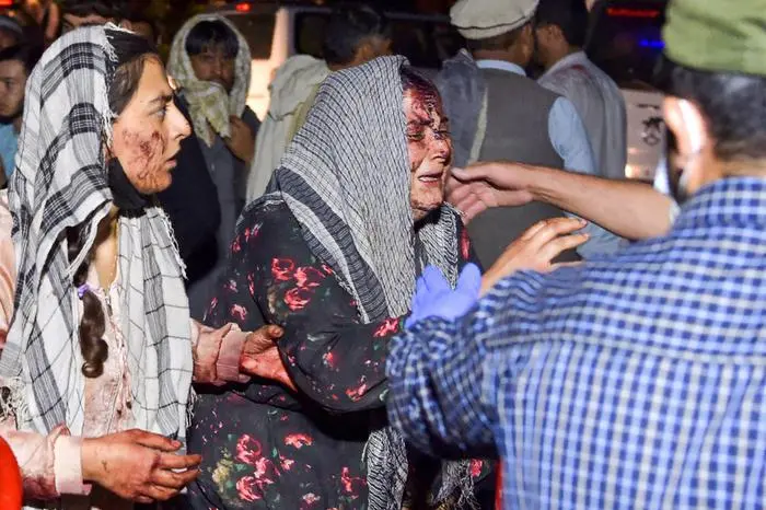 EDITORS NOTE: Graphic content / Wounded women arrive at a hospital for treatment after two blasts, which killed at least five and wounded a dozen, outside the airport in Kabul on August 26, 2021. (Photo by Wakil KOHSAR / AFP)