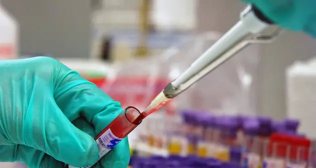 Covid: scoperto 'anticorpo universale', jolly contro più coronavirus e varianti