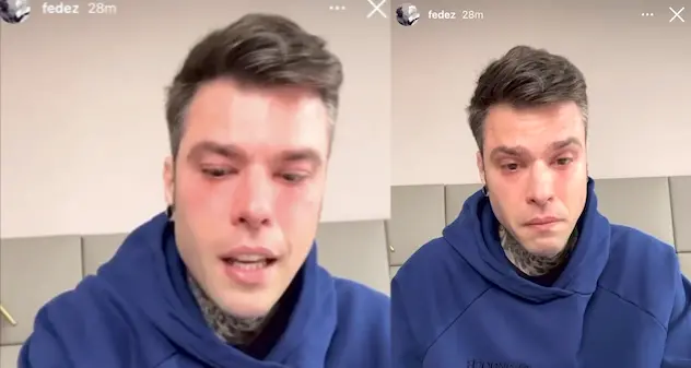 Fedez: “Mi è stato trovato un problema di salute che comporta un percorso importante”