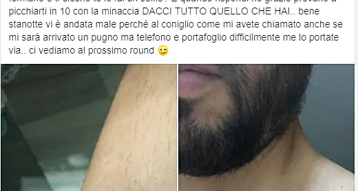 Aggredito in spiaggia vicino al Frontemare, pugni e calci: “Facciamo un selfie? No, poi le botte”