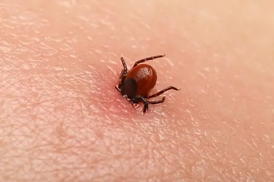  Encephalitis tick  Ticks on human skin. Ixodes ricinus can transmit both bacterial and viral pathogens such as the causative agents of Lyme disease and tick-borne encephalitis.