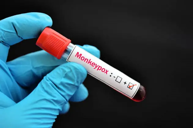 Blood sample tube positive with Monkeypox virus, new epidemic disease in 2022