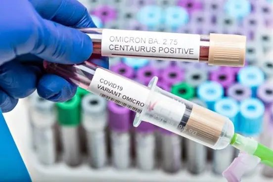 Positive blood infection sample in test tube for CENTAURUS BA 2.75 omicron covid19 coronavirus in lab. Scientist holding to check and analyze for patient in hospital