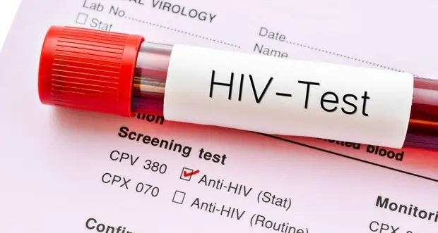 Hiv: test gratuiti lunedì a Cagliari