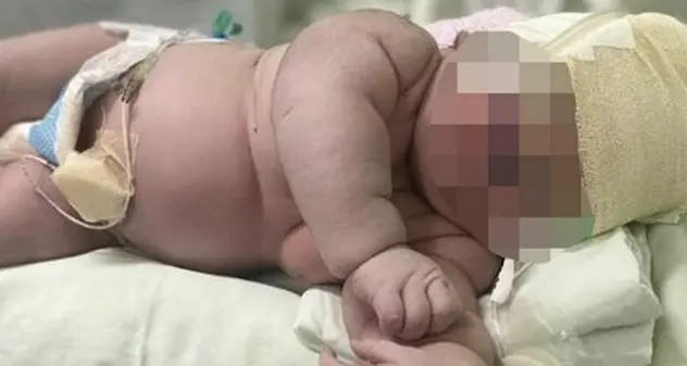 Parto da record: nasce bimbo gigante di 7 chili e mezzo