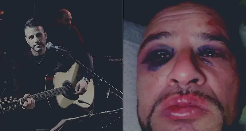Sassari: il cantante Luca Tilocca pestato a sangue fuori da un locale