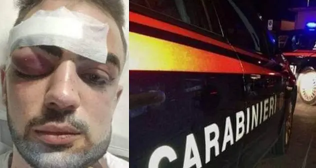 Sennori. Colpito a martellate: l'aggressore è un minorenne