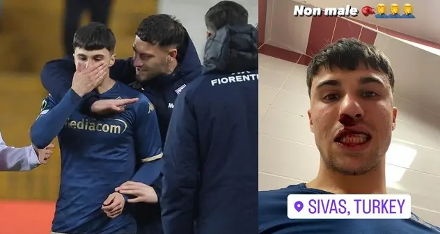 Fiorentina, Bianco colpito da un pugno da invasore di campo durante match con Sivasspor