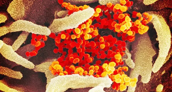 Coronavirus. Sardigna Libera: “Giusto adottare misure di prevenzione, ma il panico è ingiustificato”