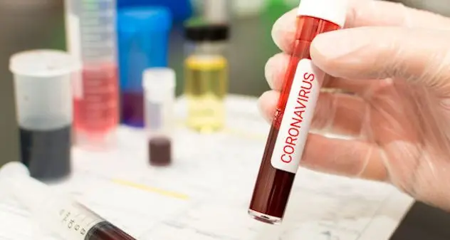 Coronavirus. Tutti gli alberghi verso la chiusura