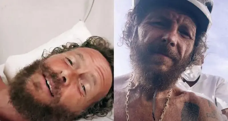 Jovanotti, incidente in bici a Santo Domingo: \"Rotti clavicola e femore\"