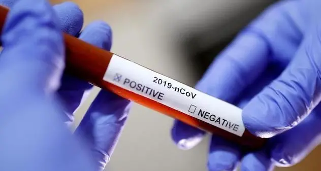 Arriva il test per il Covid modello \"etilometro\": rileva il virus nel respiro