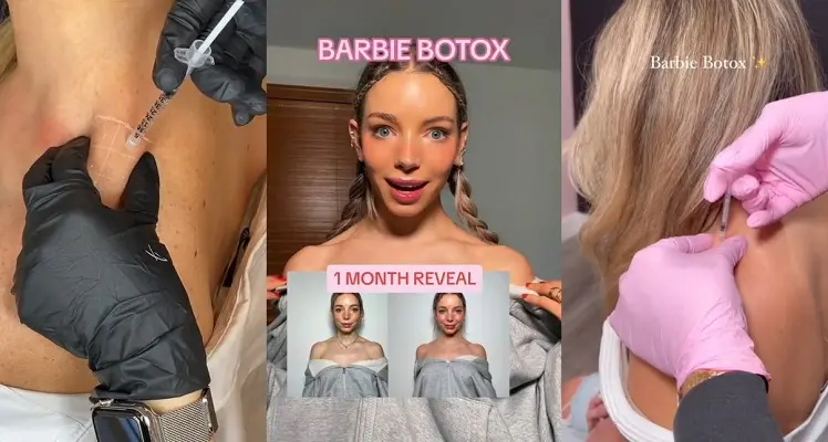 \"Barbie Botox\", l'intervento estetico per assomigliare alla bambola è virale su TikTok