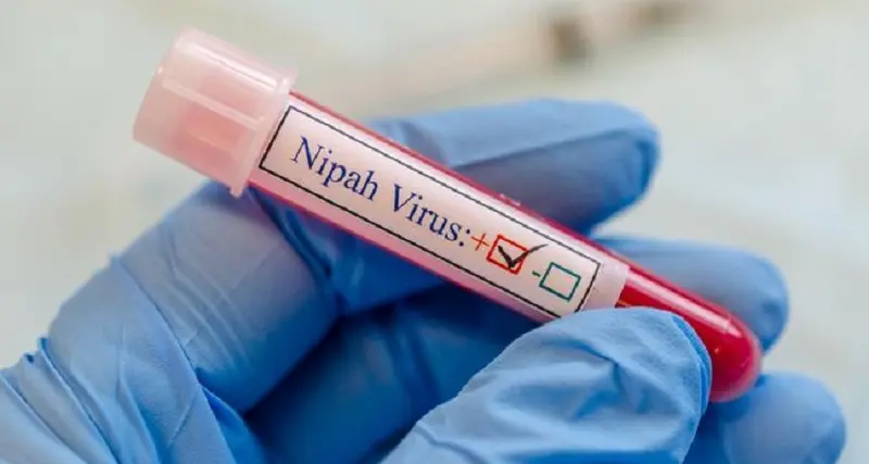 Allarme in India per il virus Nipah: cos'è