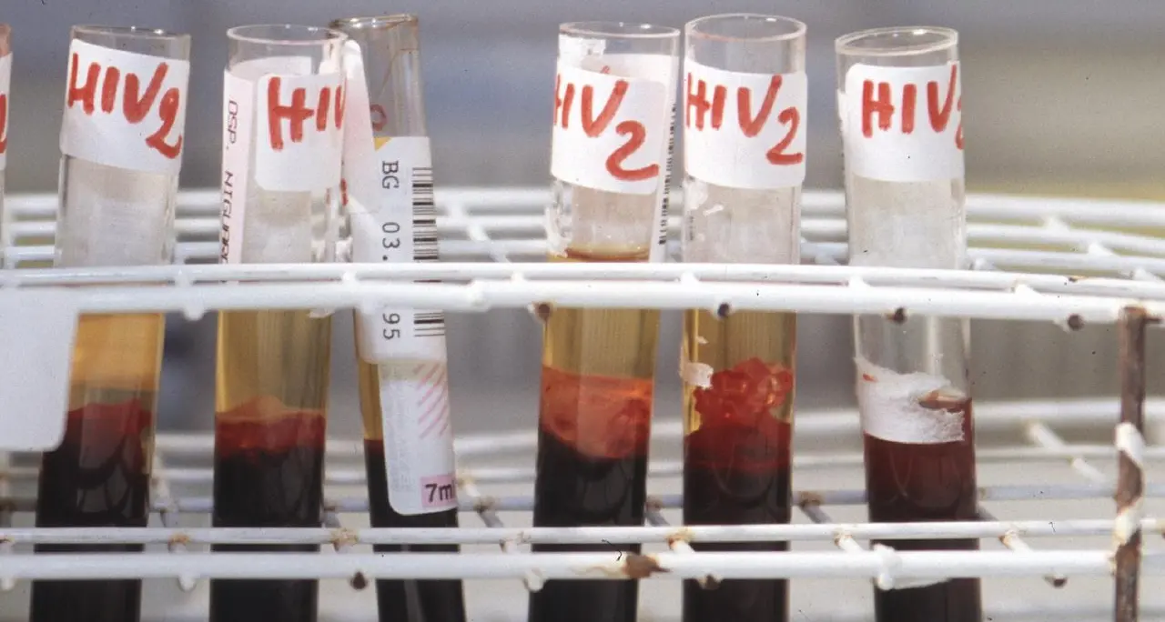 Aids: Iss, casi Hiv tornano a salire dopo 10 anni, un terzo diagnosi in over 50