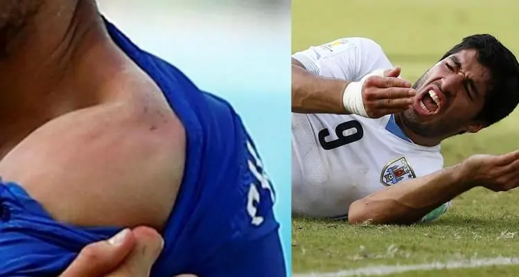 Il morso di Suarez a Chiellini