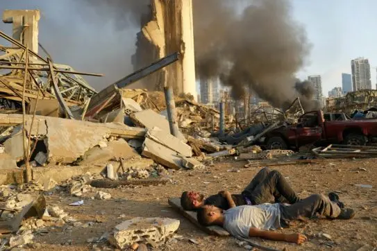 EDS NOTE: GRAPHIC CONTENT - Two injured men lie on the ground, waiting for help at the explosion scene that hit the seaport, in Beirut Lebanon, Tuesday, Aug. 4, 2020. Massive explosions rocked downtown Beirut on Tuesday, flattening much of the port, damaging buildings and blowing out windows and doors as a giant mushroom cloud rose above the capital. Witnesses saw many people injured by flying glass and debris. (AP Photo/Hussein Malla)