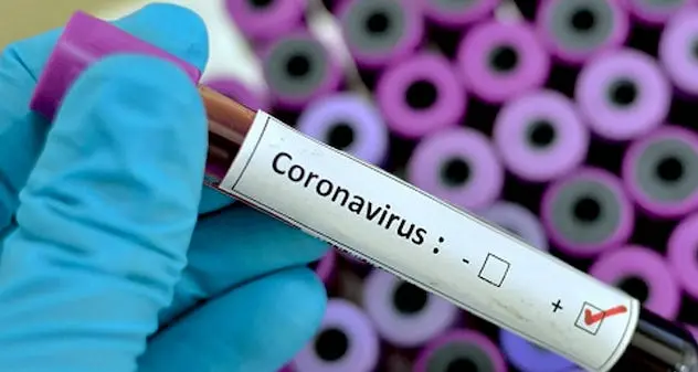 Coronavirus, in Italia 642 nuovi casi e 7 morti