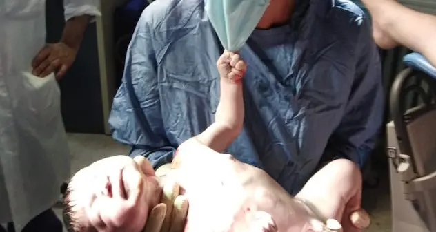 Il neonato strappa la mascherina all'ostetrica, la foto diventa simbolo del Natale