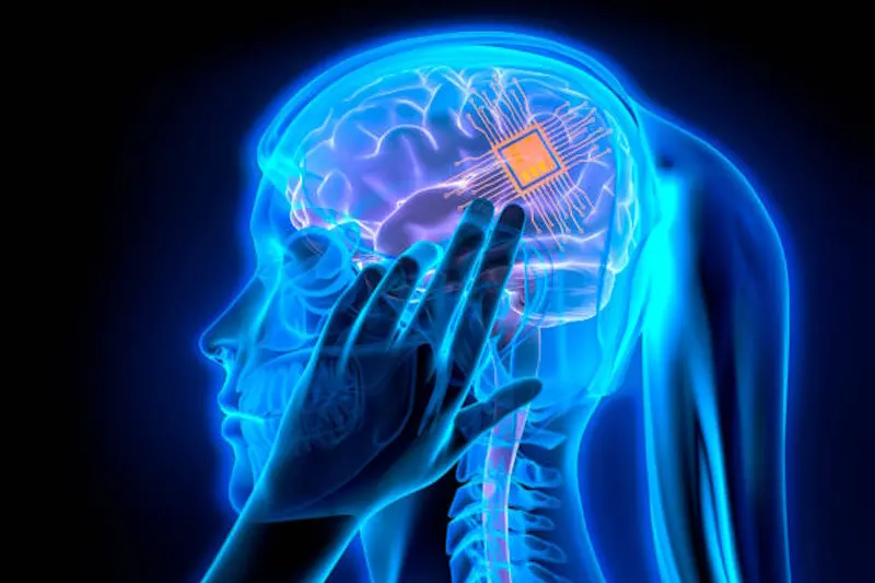 Woman with electronic micro chip brain implant - dark blue background - 3D illustration