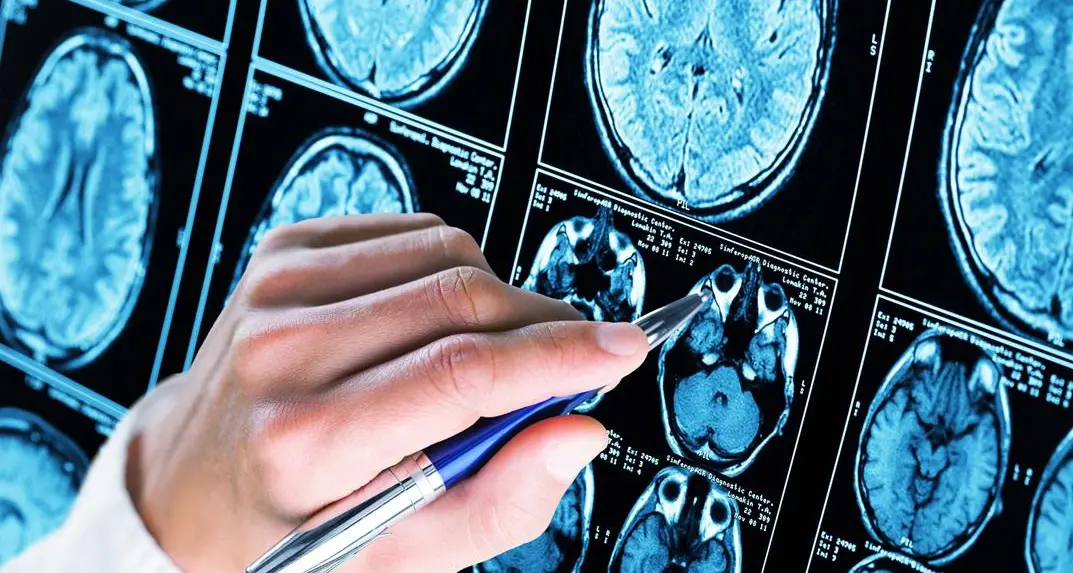 Iss, scoperto meccanismo chiave Alzheimer, speranza per diagnosi e cure