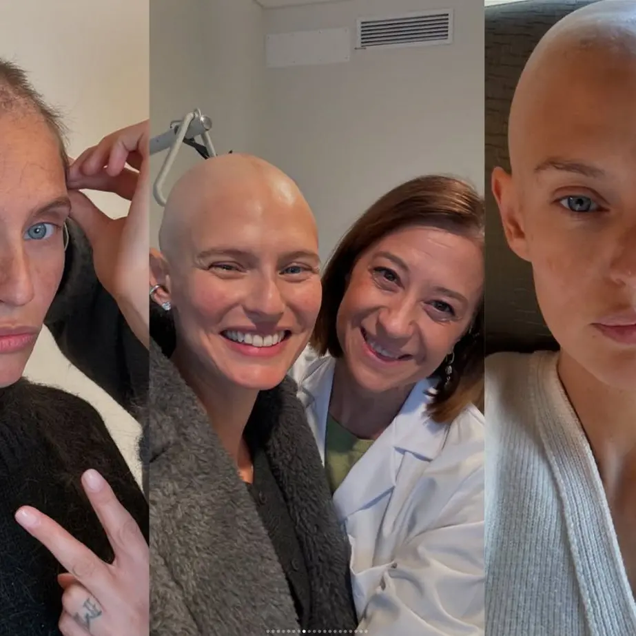 Giornata contro il cancro. Bianca Balti racconta il suo viaggio nella malattia: dolore, amore e voglia di vivere