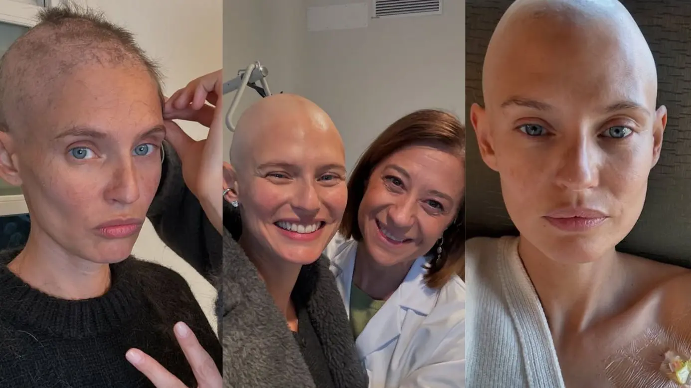 Giornata contro il cancro. Bianca Balti racconta il suo viaggio nella malattia: dolore, amore e voglia di vivere