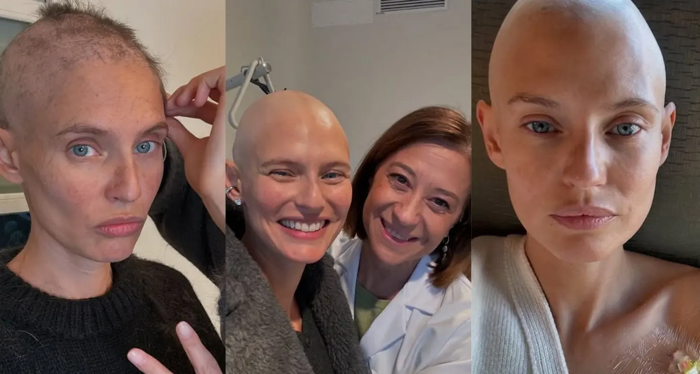Giornata contro il cancro. Bianca Balti racconta il suo viaggio nella malattia: dolore, amore e voglia di vivere