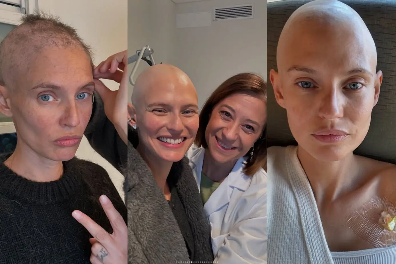 <p>Le foto pubblicate dalla modella nella Giornata mondiale contro il cancro</p>\\n
