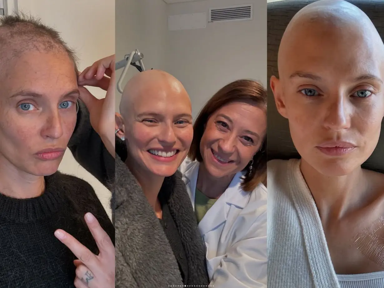Giornata contro il cancro. Bianca Balti racconta il suo viaggio nella malattia: dolore, amore e voglia di vivere