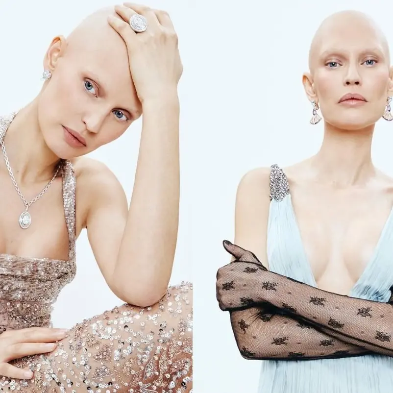 Bianca Balti illumina Sanremo: eleganza, forza e un messaggio potente di celebrazione della vita