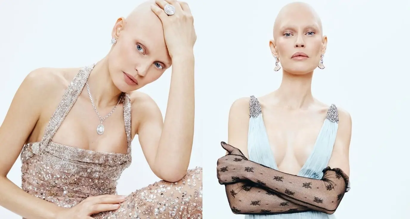 Bianca Balti illumina Sanremo: eleganza, forza e un messaggio potente di celebrazione della vita