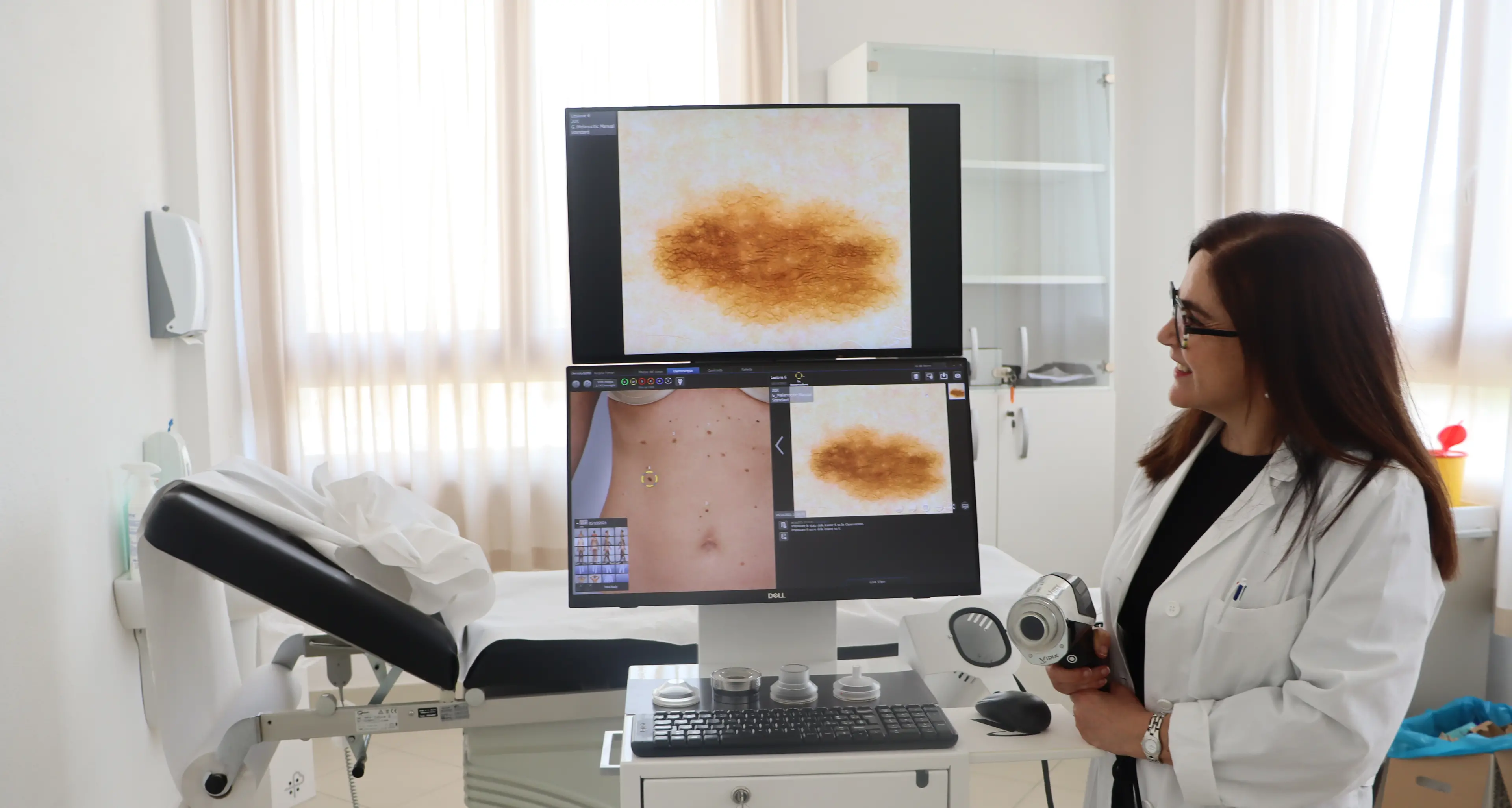 Nuovo videodermatoscopio alla Casa della Comunità San Francesco di Nuoro