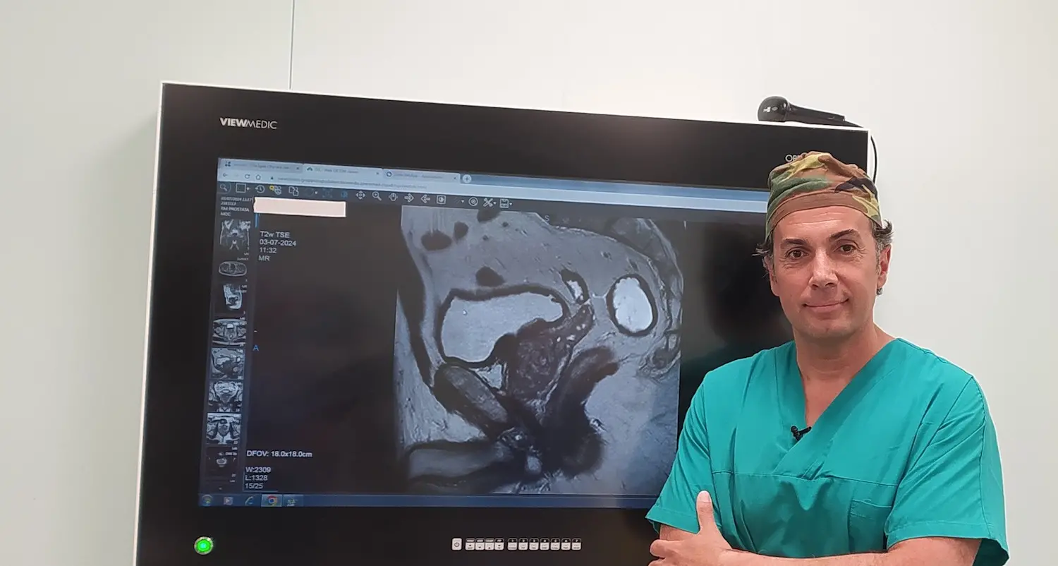Urologia mininvasiva: per la prima volta in Sardegna impiantato il device iTind