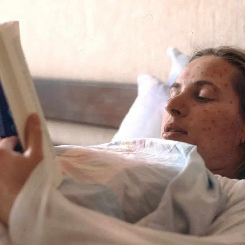 Italia in allerta morbillo, l'esperto: \"Necessario vaccinare, copertura sotto il target OMS\"