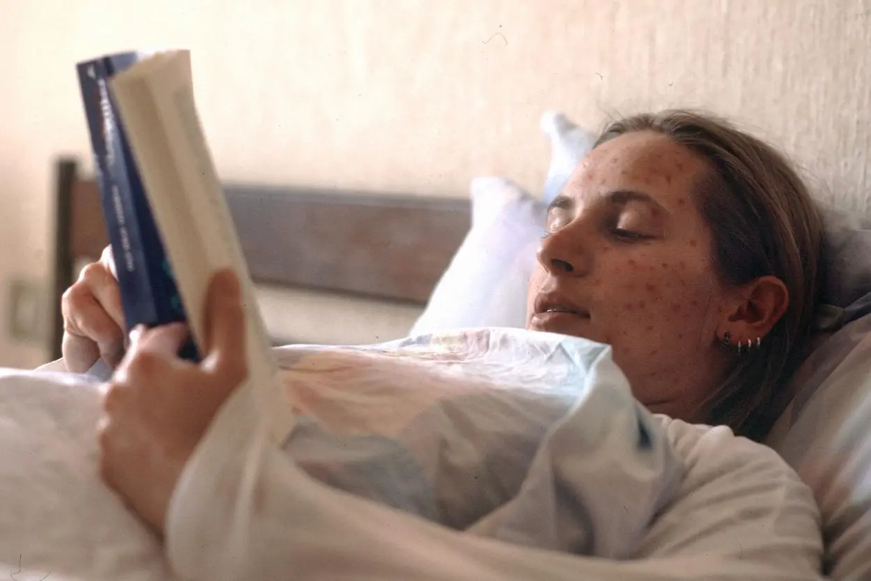 Italia in allerta morbillo, l'esperto: \"Necessario vaccinare, copertura sotto il target OMS\"