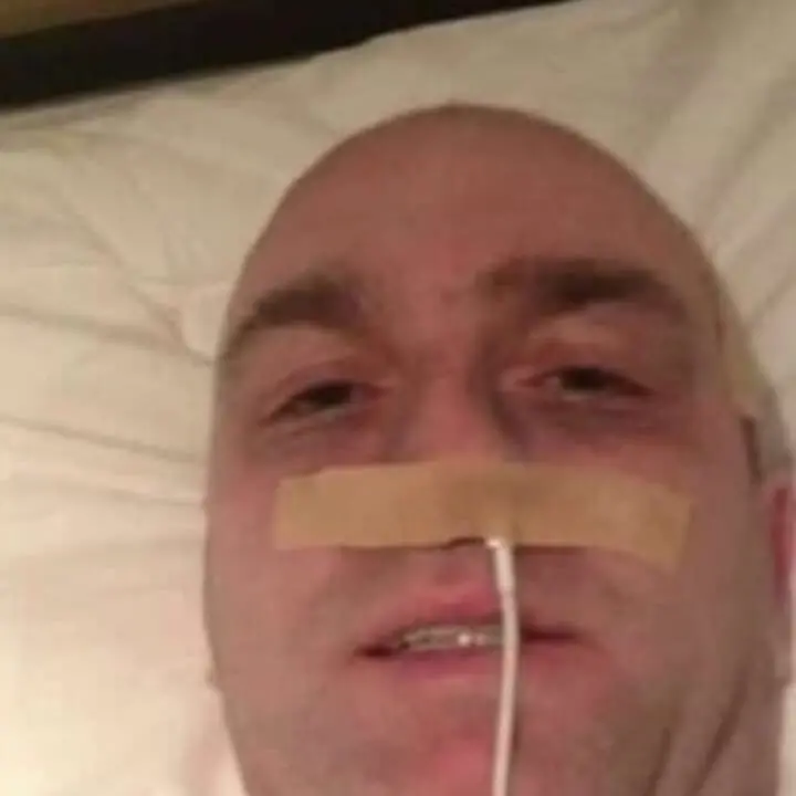 Simula il cancro infilando un cavo iPhone nella narice: ex campione truffa migliaia di fan