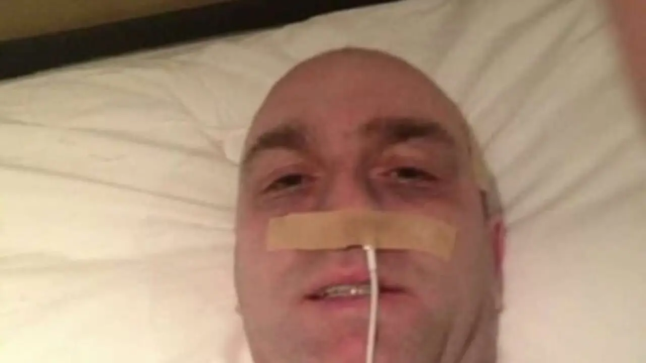 Simula il cancro infilando un cavo iPhone nella narice: ex campione truffa migliaia di fan
