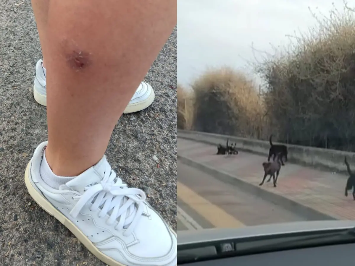 Consigliera aggredita da 9 cani randagi a Cagliari: “Serve un intervento immediato”