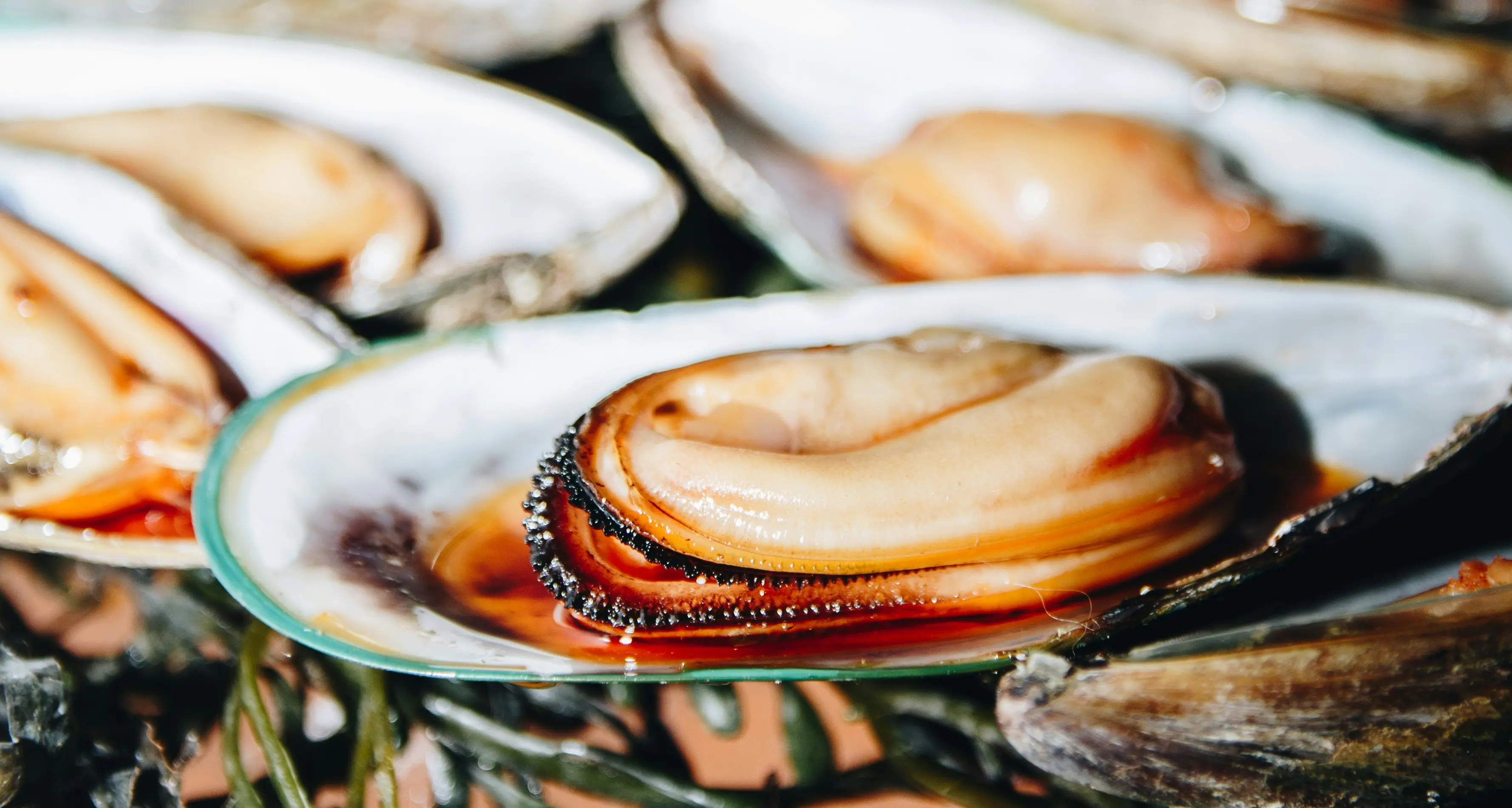 Epatite A in aumento in Italia: tra le cause principali il sesso e i cibi contaminati