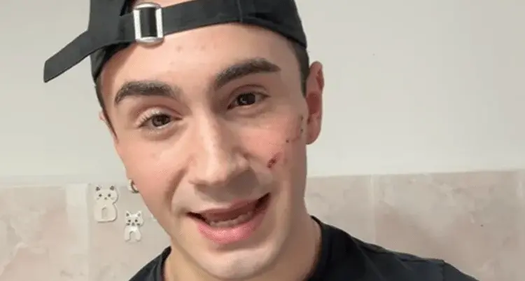 Genova, ballerino 19enne denuncia aggressione omofoba: colpito al volto con un coltello