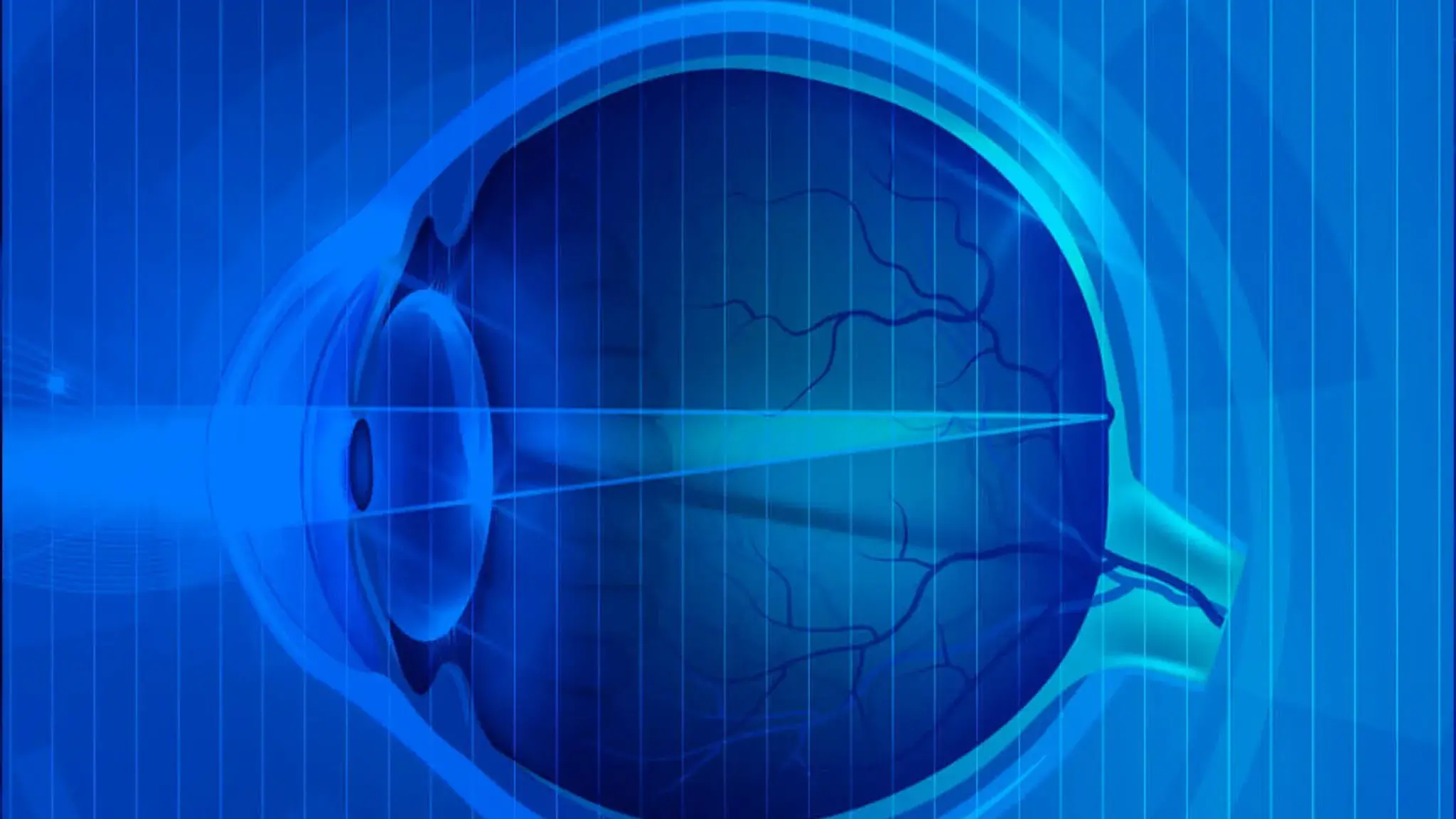 Screening sul glaucoma a Cagliari: su 120 visite rilevati 18 casi da approfondire