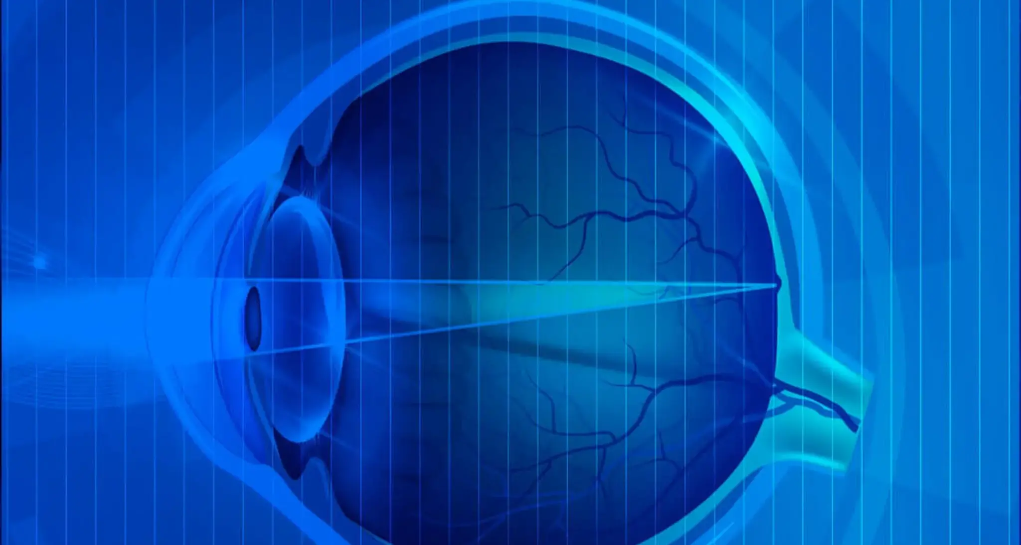 Screening sul glaucoma a Cagliari: su 120 visite rilevati 18 casi da approfondire