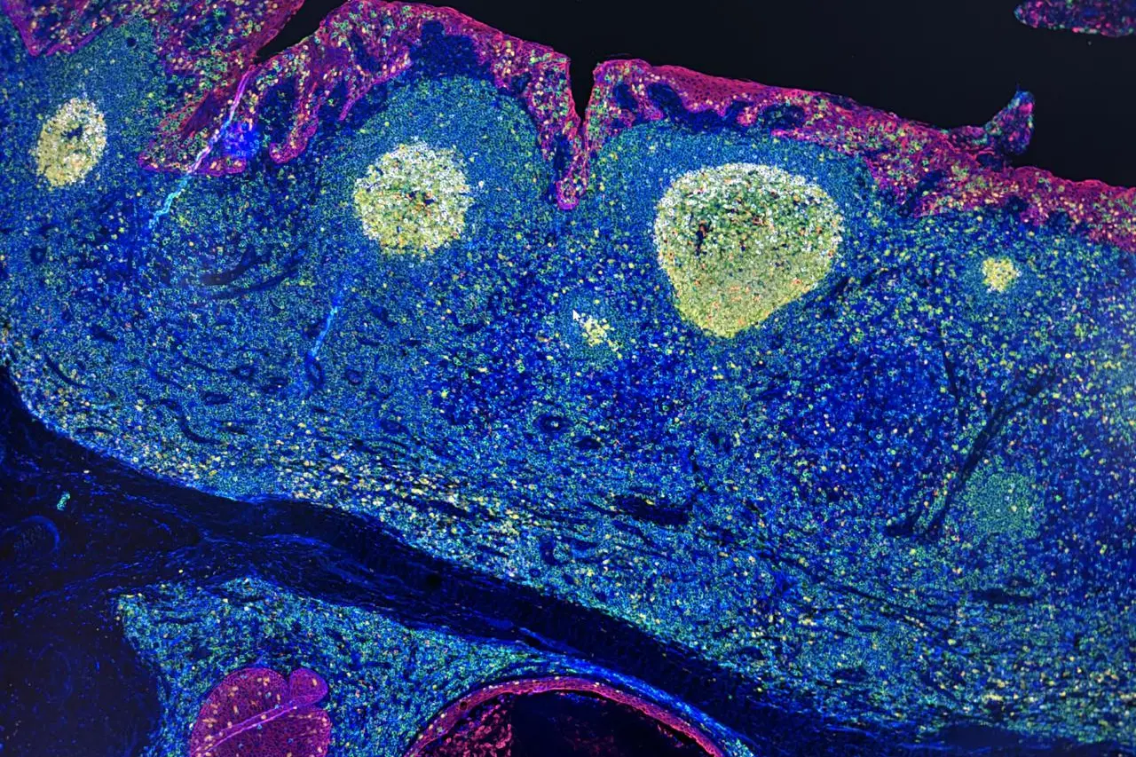 Irccs Pascale Napoli, 'mappa Gps' delle cellule rivoluziona l'immunoterapia