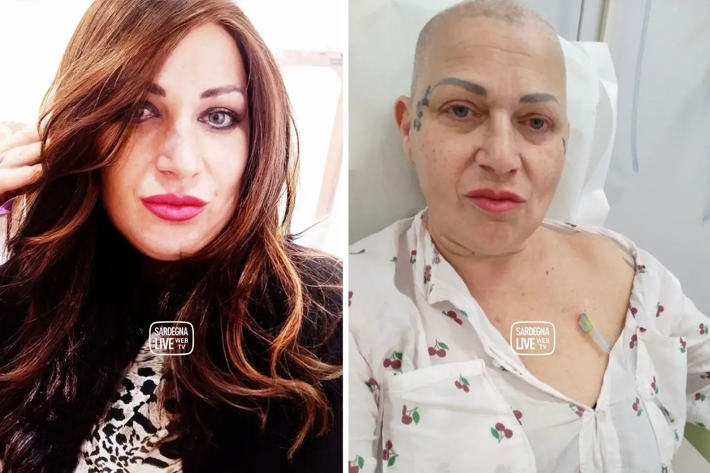 \"Mi avevano dato 6 mesi di vita. Sono qui da 9 anni\". Storia di Barbara Contu, paziente oncologica di Selargius